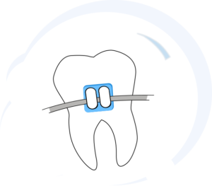 Braces_HomePage Braces_HomePage